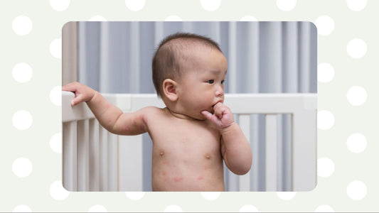 Impetigo in Babies: How to Identify, Treat & Prevent Spreading